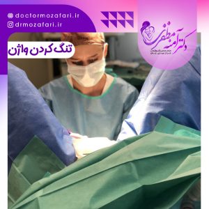 تنگ کردن واژن در شیراز