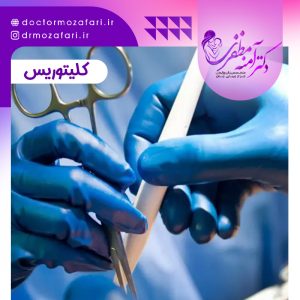 جراحی کلیتوریس در شیراز