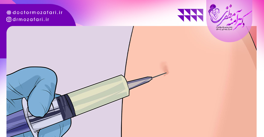 درمان خانگی زگیل تناسلی