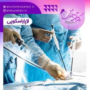 لاپاراسکوپی