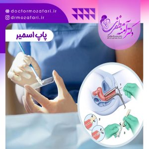 تست پاپ اسمیر