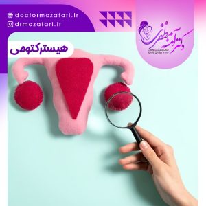 هیسترکتومی