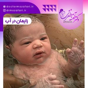 زایمان در آب