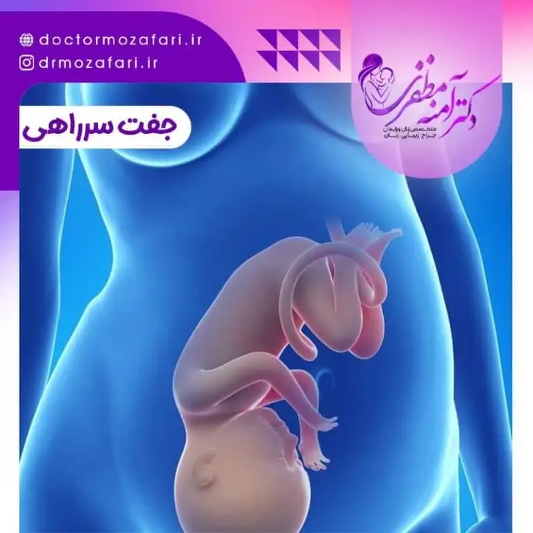 جفت پایین در بارداری