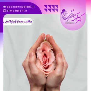 مراقبت های بعد از لابیاپلاستی