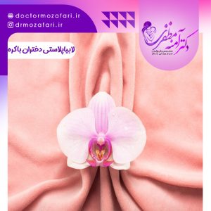 لابیاپلاستی برای دختران باکره