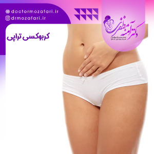 کربوکسی تراپی واژن