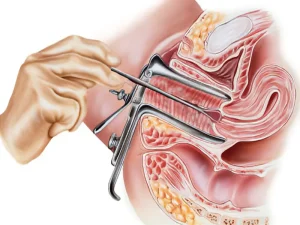 بهترین دکتر متخصص کولپوسکوپی در شیراز